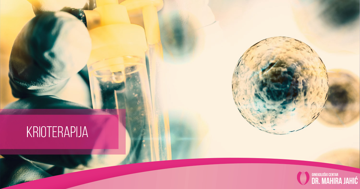 Krioterapija