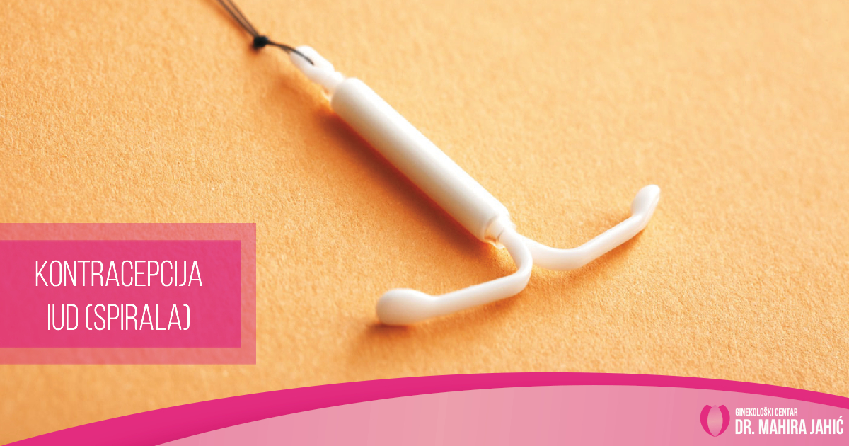 Kontracepcija – IUD (spirala)