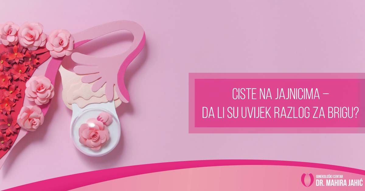 Ciste na jajnicima – da li su uvijek razlog za brigu?